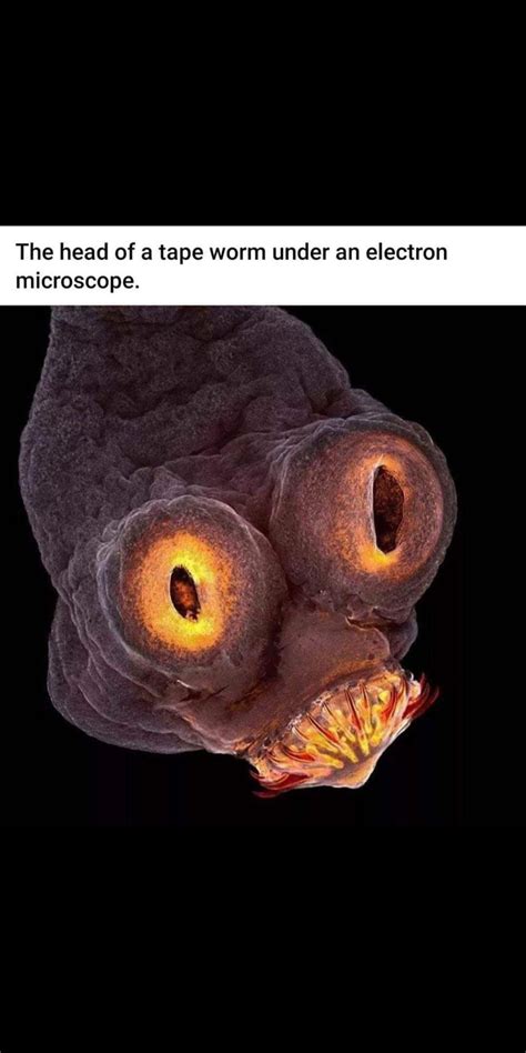 Tapeworm up close, it's teeth! : r/oddlyterrifying