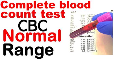 Rbc normal range | 👉👌Low Red Blood Cell Counts