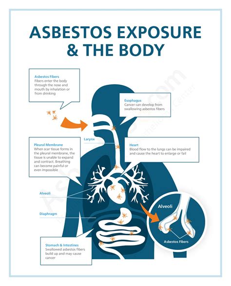 Diagram showing how asbestos exposure affects the body Heart Blood Flow ...