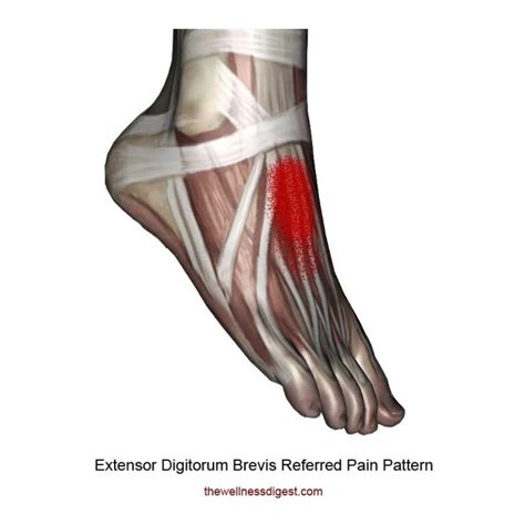 Extensor Digitorum Brevis Muscle: Pain In The Top Of The Foot - The Wellness Digest