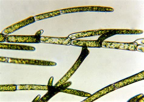 Cladophora Microscope Labeled