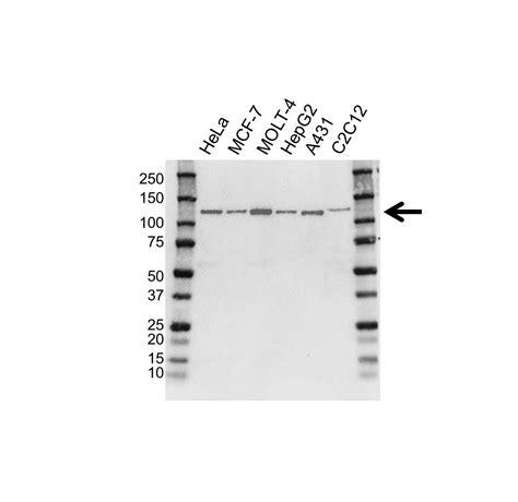 Anti CD30 Antibody, clone OTI3B10 (PrecisionAb Monoclonal Antibody ...