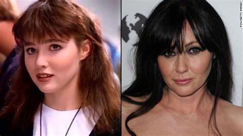 Shannen Doherty Plastic Surgery