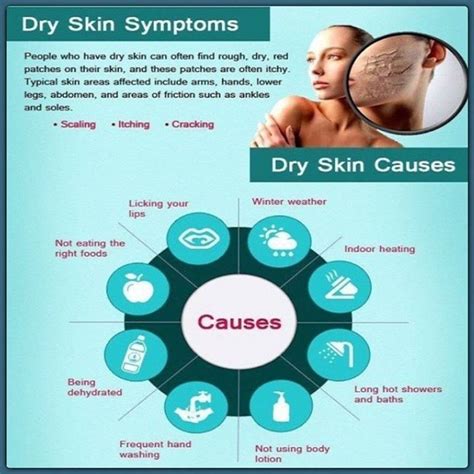 Www.gratitudebeauty.com Www.facebook.com/gratitudebeauty | Dry skin ...