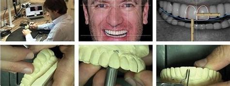 Discover the Evolution of Smile Design Techniques: A Comprehensive…