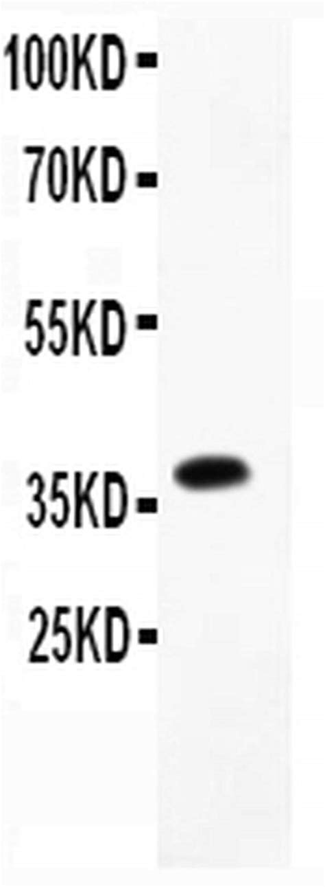 CD23 Antibody (PA5-79242)