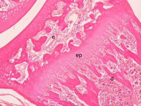 Epiphyseal plate