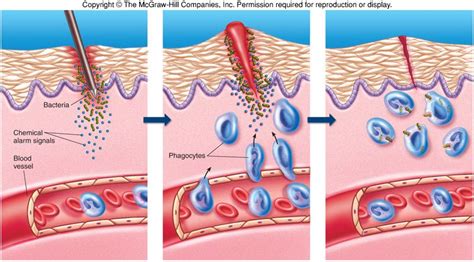 inflammatory response - basic | Immunology, Second line, Systems biology