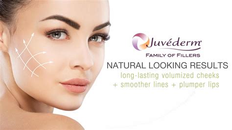 Juvederm in Newburgh, NY | Hudson Valley | Dr. Rubinstein