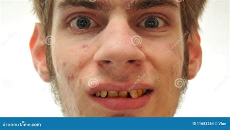 Ugly Man Smiling with Crooked Yellow Teeth Stock Photo - Image of ...