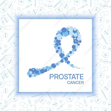 Prostate cancer, illustration - Stock Image - F032/3593 - Science Photo Library