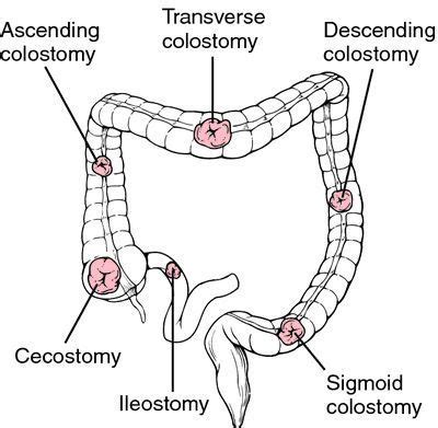 stoma - definition of stoma in the Medical dictionary - by the Free Online Medical Dictionary ...