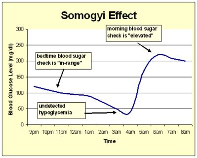 Undiagnosed diabetes symptoms weight loss, somogyi effect dawn phenomenon treatment