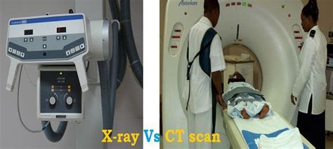 Difference Between X-ray and CT scan (with Comparison Chart) - Bio ...