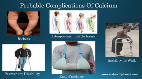 Common Causes And Symptoms Of Calcium Deficiency