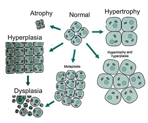 Lecture Notes in Medical Technology: Lecture #2: Mechanism of Cell Damage