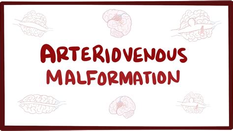 Arteriovenous malformation (AVM) - causes, symptoms, diagnosis, & pathology | Youtube, Pathology ...