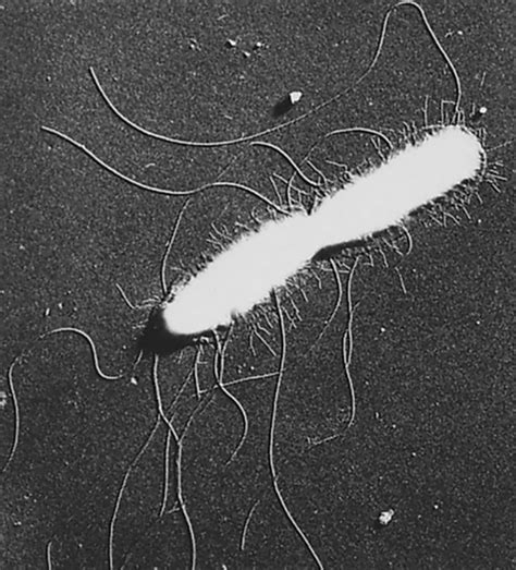 Salmonella | Classification, Species, & Human Infection | Britannica