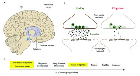 Parkinson's Disease Dopaminergic Neurons - Captions Update Trendy