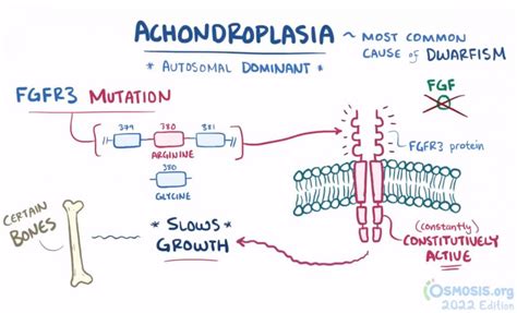 Achondroplasia Gene Mutation