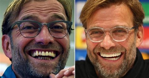 Has Jurgen Klopp Had His Teeth Done Liverpool Boss Flashes It Looks Like Jurgen Klopp Has Been ...