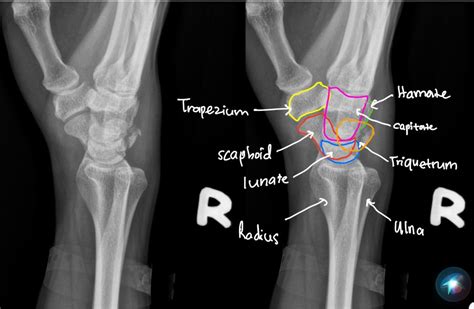 Quiz 36 MSK – Radiology Cases