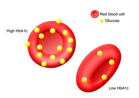 How Does High Blood Sugar Affect the Heart? | Everlywell