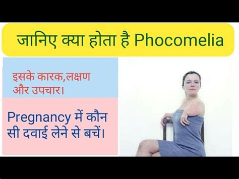 What is Phocomelia, it's cause and treatment. - YouTube