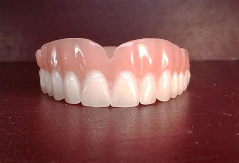 Denture upper false teeth by denturestore on Etsy