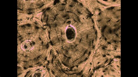 Lab 1.5 - Structures of Compact Bone (Microscope) - YouTube