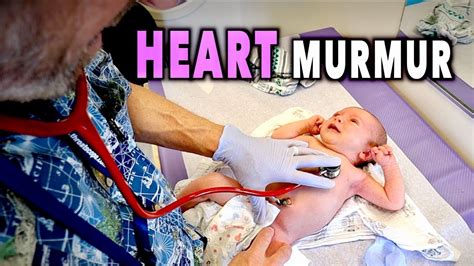 NEWBORN HEART MURMURS: What You Need to Know | Dr Paul - YouTube