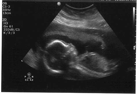 The Starr Family Blog: Baby Boy Ultrasound