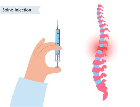 5 Lesser Known Key Details About a Nerve Block - Fit Living Tips