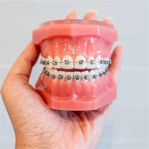 Braces for Adults in Los Angeles County - CaliSmile Orthodontics