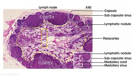 Lymphoid tissue - Histology (lymph node, spleen, thymus, tonsil) - YouTube