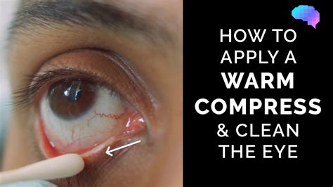 Diy warm eye compress - doctorsshery