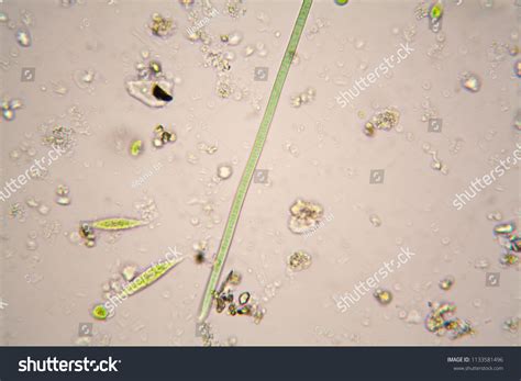 Microorganisms In Pond Water Under Microscope