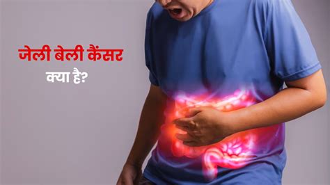 जेली बेली कैंसर क्या है? जानें इसके कारण, लक्षण और इलाज | what is jelly belly cancer symptoms ...