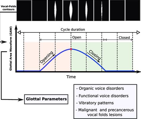 Graphical illustration of the procedure followed to extract glottal... | Download Scientific Diagram