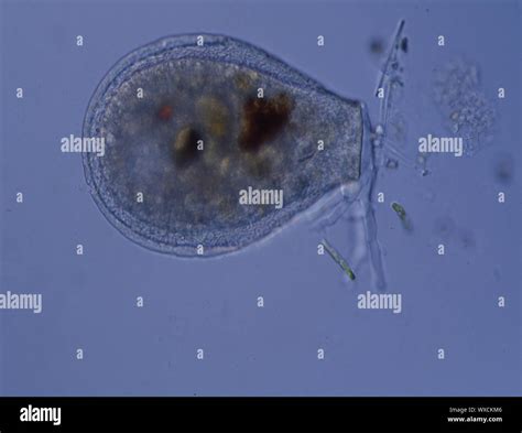 Cup amoeba with pseudopods under the microscope 100x Stock Photo - Alamy