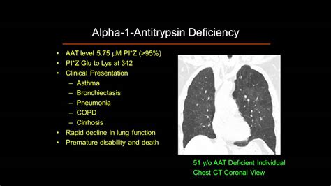 Alpha-1 Antitrypsin Deficiency 101: Lung - YouTube