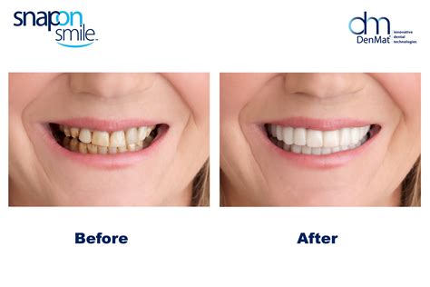 A New Smile in a Snap - Your Dental Health Resource