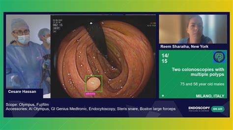 Colonoscopy and polypectomy - Endoscopy On Air