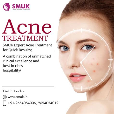 Acne treatment – Artofit