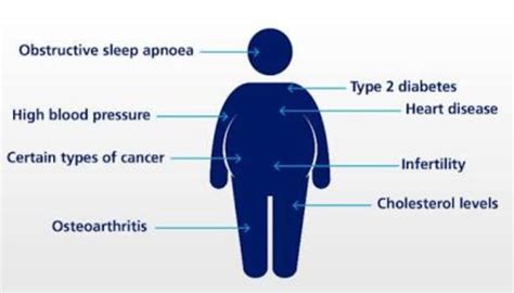 Obesity Treatment in Pune | Obesity Surgery in Pune | Obesity clinic in Pune | Doss India