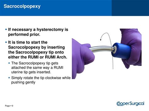 PPT - Sacrocolpopexy – Understanding the Procedure PowerPoint Presentation - ID:1770438