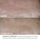 Dr Dennis Gross Skincare Advanced Retinol and Ferulic Perfectly Dosed ...