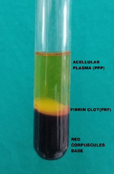 Blood centrifugation immediately after collection allows the... | Download Scientific Diagram