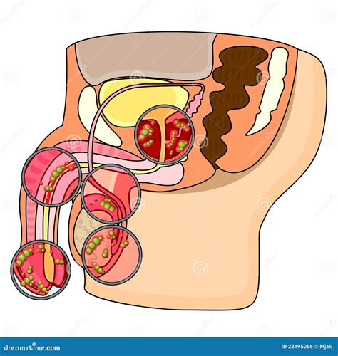 Diseases Of Male Reproductive System Vector Illustration | CartoonDealer.com #28195056