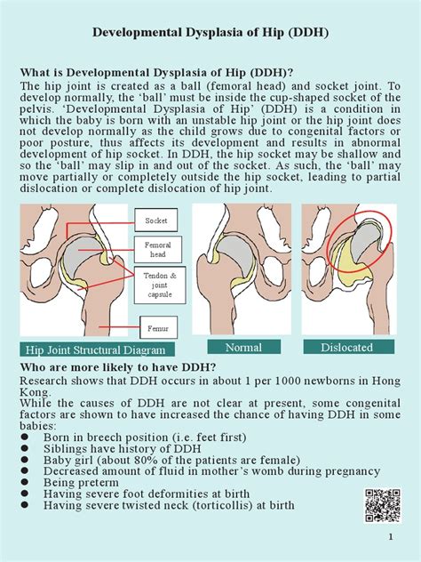 DDH.pdf | Hip | Musculoskeletal System